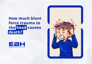 How much blunt force trauma to the head causes death